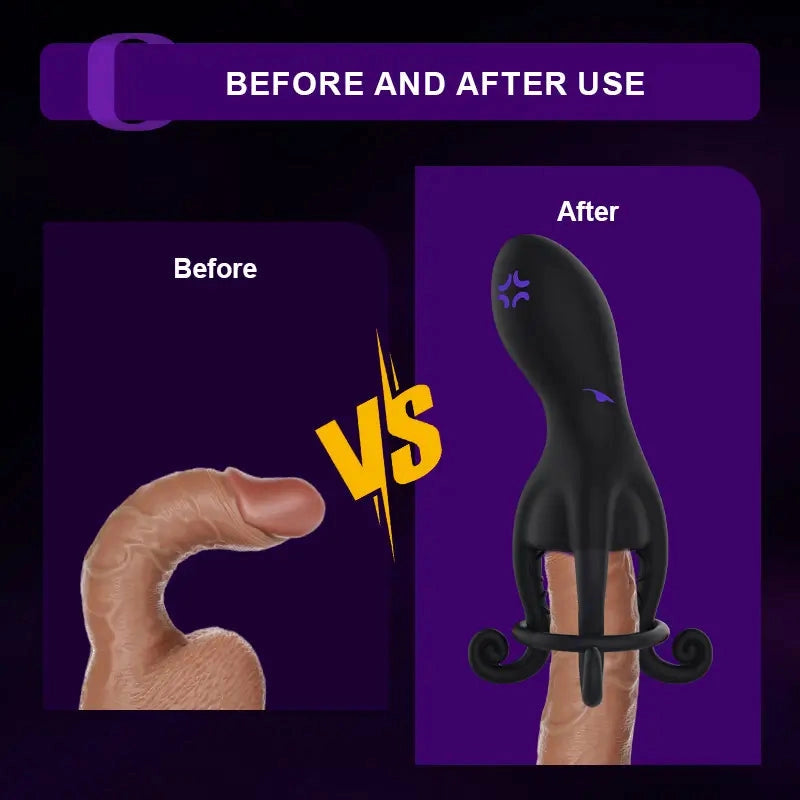 XG11: Vibrador de Glande Hands-Free con Soporte de Anillo para Pene (Cockring Support)